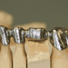 Regular Porcelain Fused to Metal (PFM) Frame Work